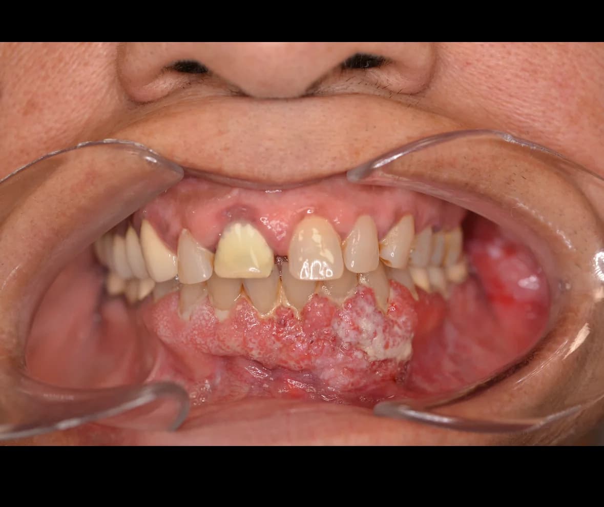 Pathologie Image 2