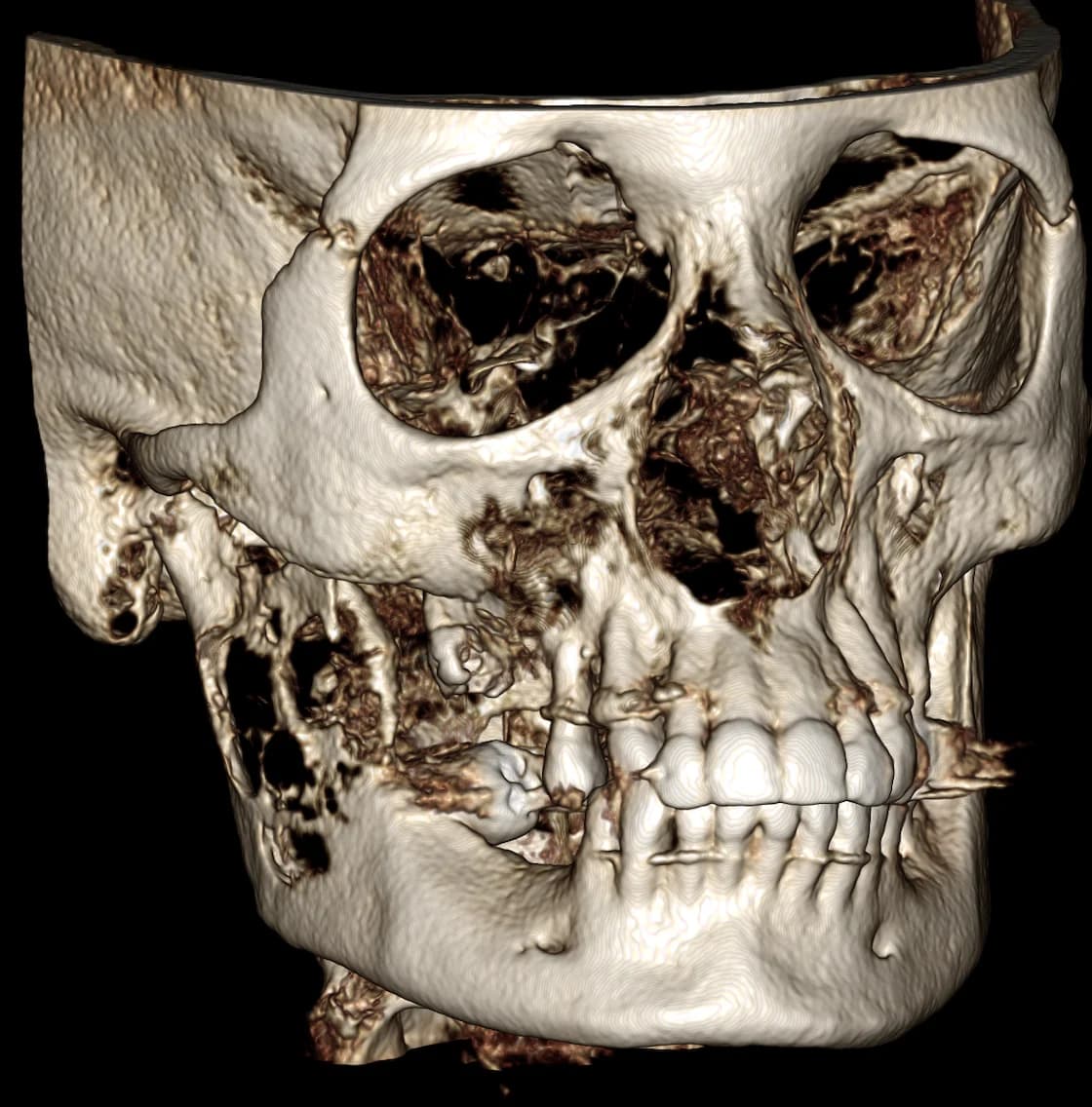 Pathologie Image 3