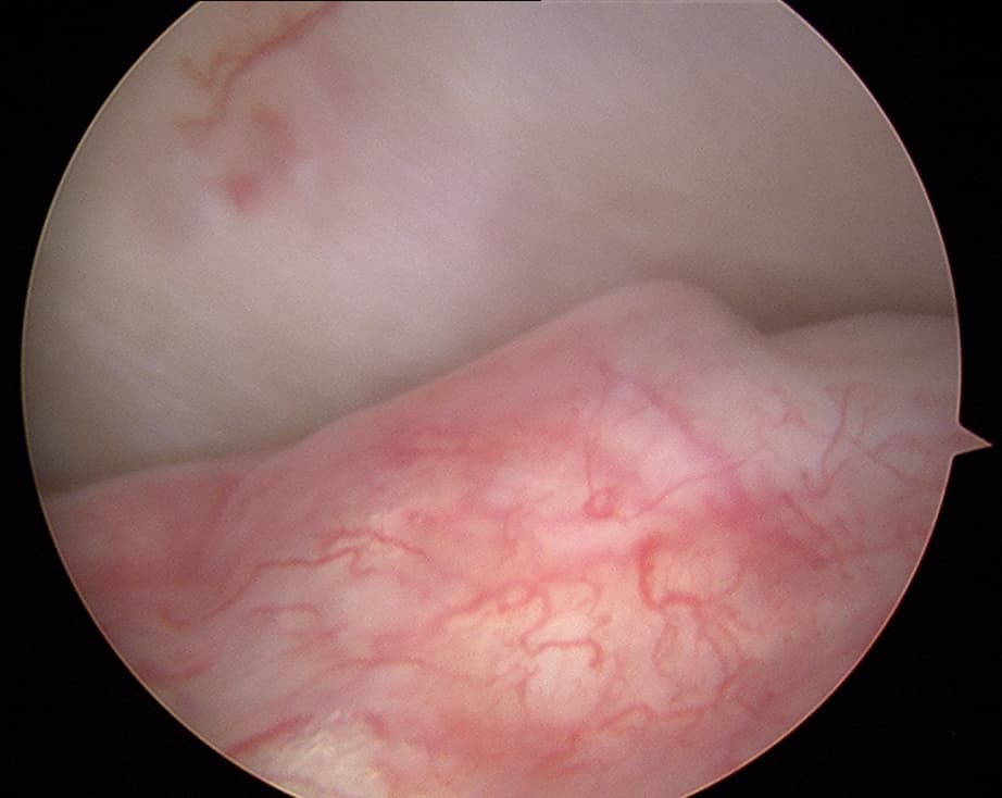 TMJ Disorders Treatment Image 2