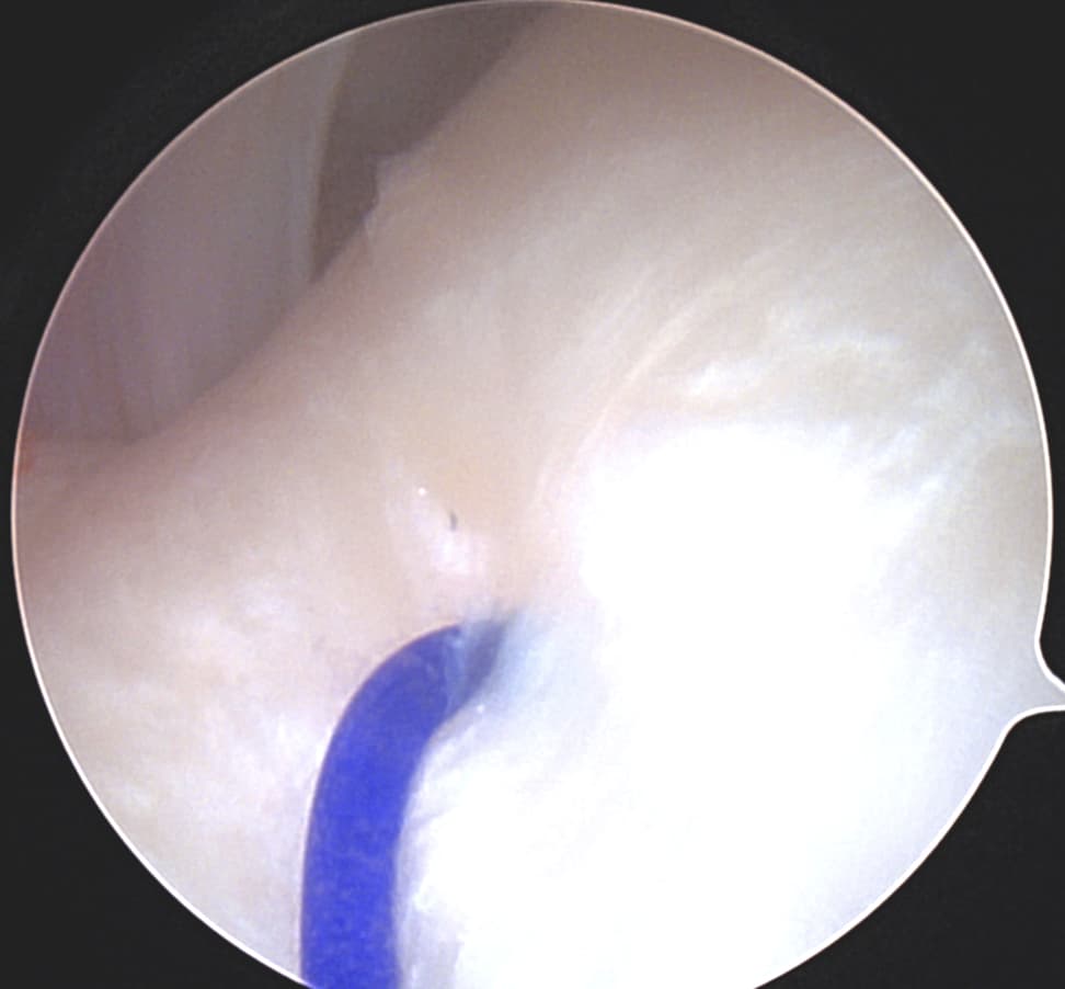 TMJ Disorders Treatment Image 4