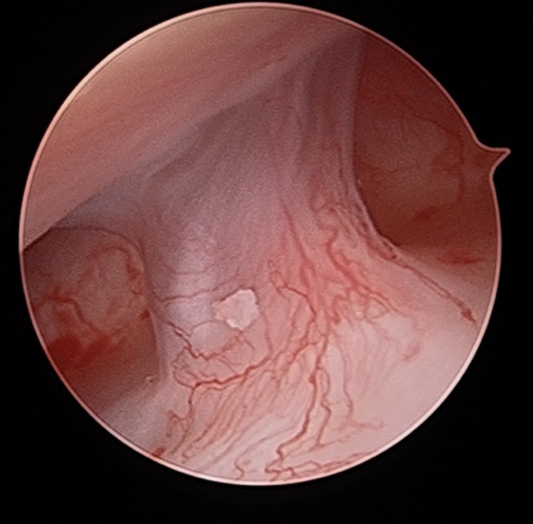 TMJ Disorders Treatment Image 3