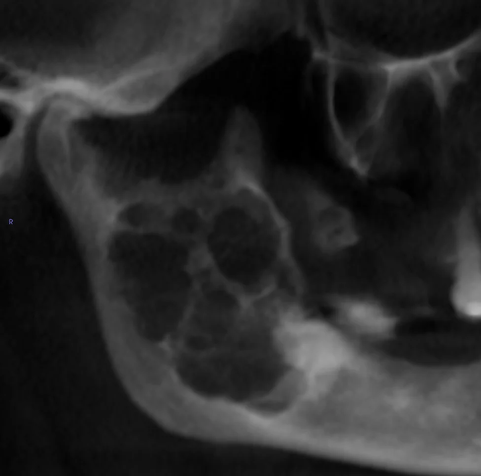 Pathology Overview Image