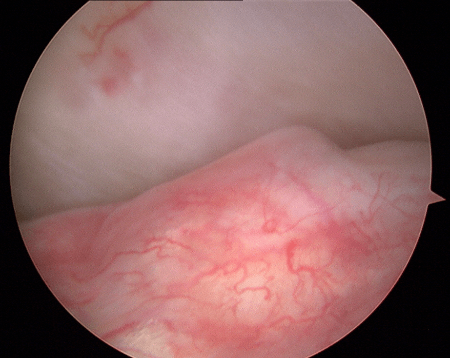 Troubles de l'ATM Image 2