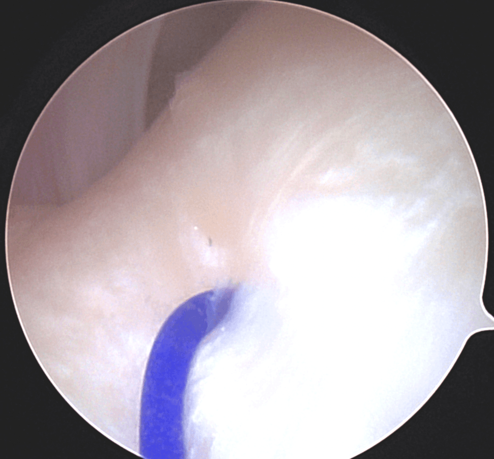 Troubles de l'ATM Image 4