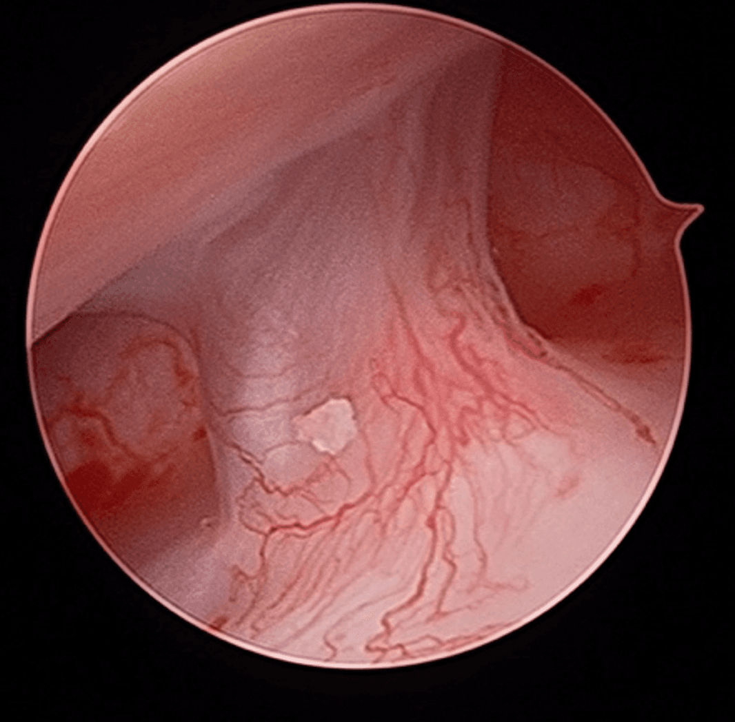 Troubles de l'ATM Image 3