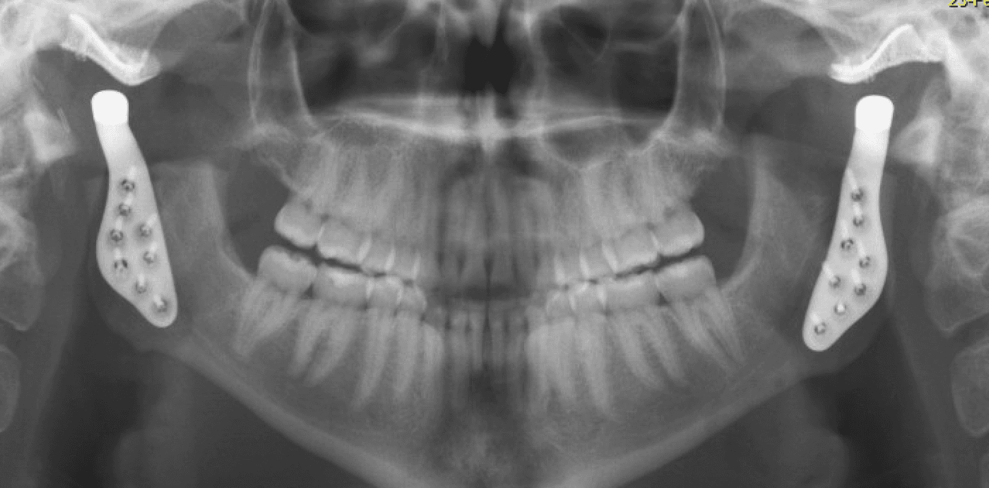 Troubles de l'ATM Image 5