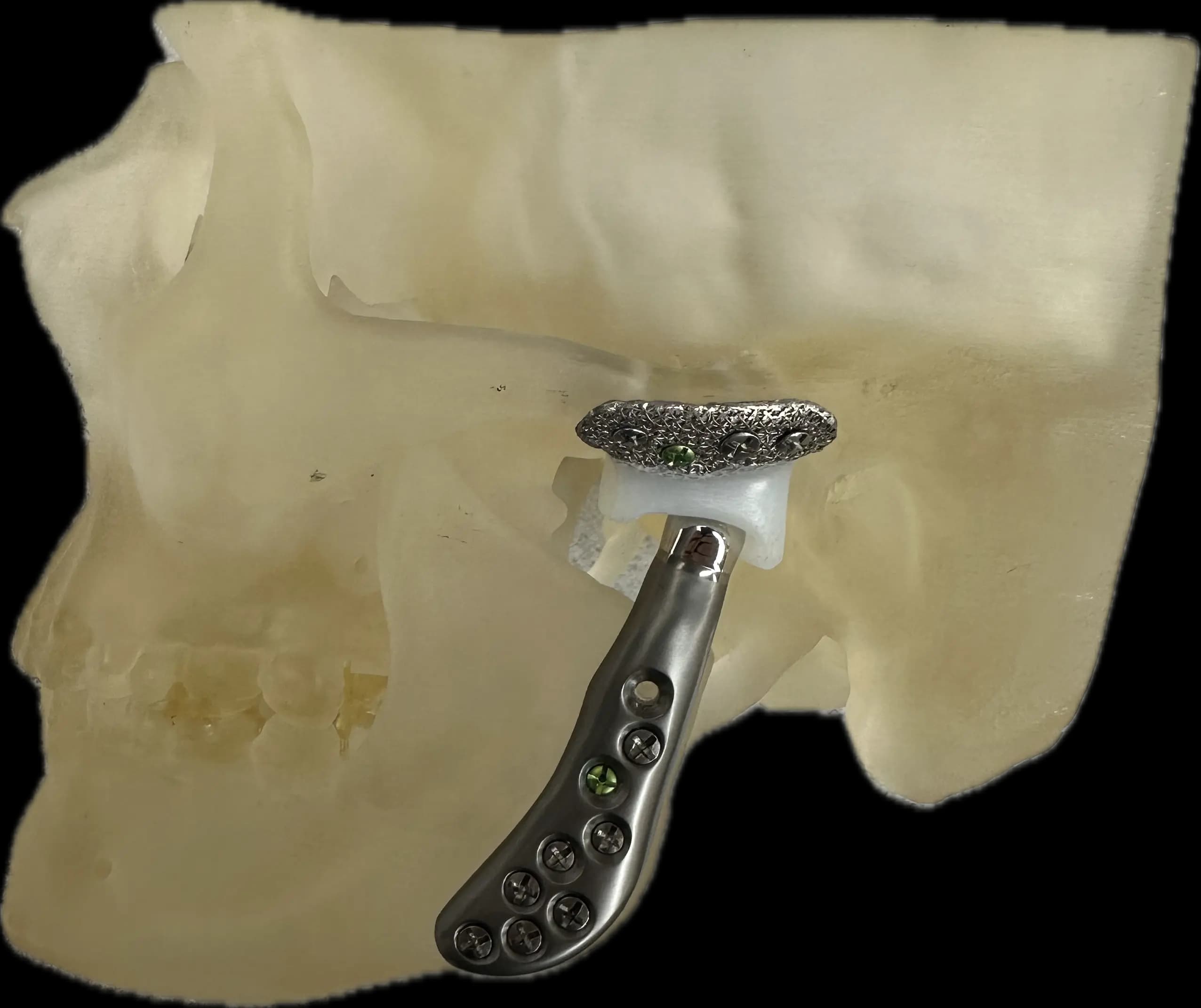 Troubles de l'ATM Image 6